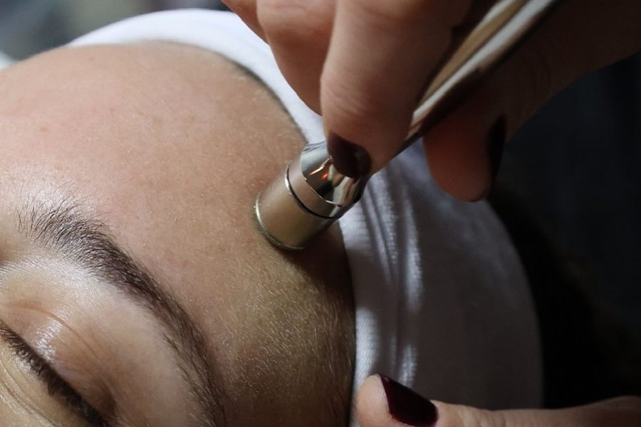 Microdermabrasion