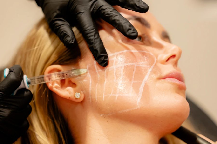Skin Boosters